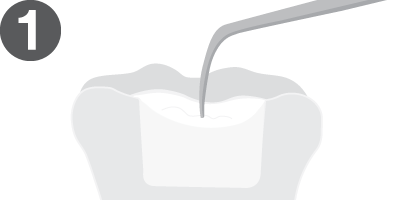 Filtek™ Bulk Fill Posterior Restorative handling icon
